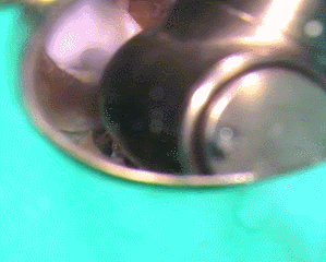 まずは封鎖セメントの除去 2016.06.30.gif